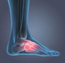 MSK Ultrasound